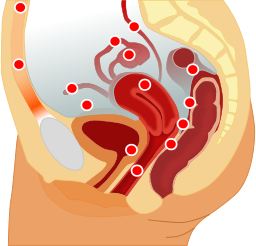 Localizzazione endometriosi